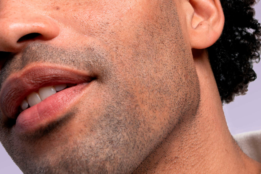 Como cuidar da tua barba e da tua pele?